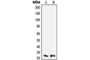 Western blot analysis of SCC-S2 expression in K562 (A), Raw264. (TNFAIP8 antibody  (Center))