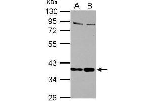 WB Image Sample (30 ug of whole cell lysate) A: Jurkat B: Raji 10% SDS PAGE antibody diluted at 1:1000 (Selenoprotein P antibody)