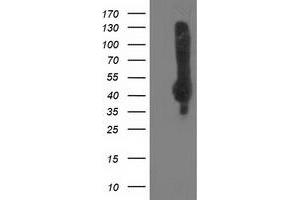 HEK293T cells were transfected with the pCMV6-ENTRY control (Left lane) or pCMV6-ENTRY NEU2 (Right lane) cDNA for 48 hrs and lysed. (NEU2 antibody)