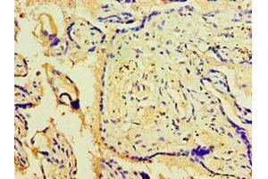Immunohistochemistry of paraffin-embedded human placenta tissue using ABIN7175707 at dilution of 1:100 (WIPI1 antibody  (AA 187-446))