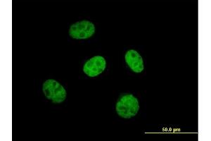 Immunofluorescence of purified MaxPab antibody to KBTBD9 on HeLa cell. (KLHL29 antibody  (AA 1-503))