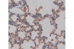 Used in DAB staining on fromalin fixed paraffin- embedded lung tissue (TAP2 antibody  (AA 467-703))