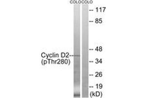 Western blot analysis of extracts from COLO205 cells treated with EGF 200ng/ml 30', using Cyclin D2 (Phospho-Thr280) Antibody.