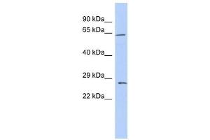 Claudin 18 antibody used at 1 ug/ml to detect target protein. (Claudin 18 antibody  (Middle Region))