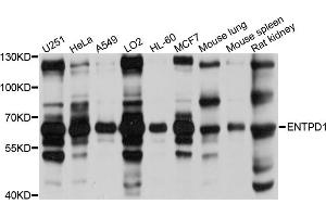 Western blot analysis of extracts of various cell lines, using ENTPD1 antibody (ABIN5971962) at 1/1000 dilution. (CD39 antibody)
