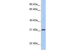 SRPRB antibody used at 1 ug/ml to detect target protein.