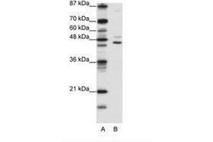 Image no. 1 for anti-Jumonji Domain Containing 4 (JMJD4) (C-Term) antibody (ABIN6736176)