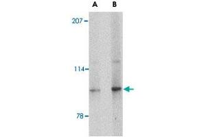 Western blot analysis of SLITRK4 in mouse brain tissue lysate with SLITRK4 polyclonal antibody  at (A) 0.