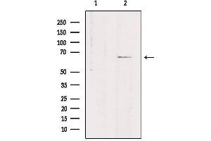 Western blot analysis of extracts from rat brain, using SLC7A4 Antibody.