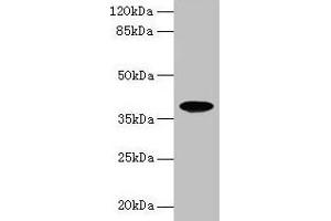 Western blot All lanes: FPR2 antibody at 8 μg/mL + HL60 whole cell lysate Secondary Goat polyclonal to rabbit IgG at 1/10000 dilution Predicted band size: 39 kDa Observed band size: 39 kDa (FPR2 antibody  (AA 307-351))