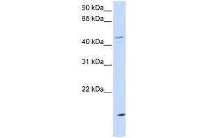CETP antibody used at 1 ug/ml to detect target protein. (CETP antibody  (N-Term))