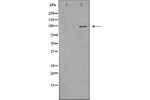 Western blot analysis of Hela whole cell lysates, using MVP Antibody. (MVP antibody  (N-Term))