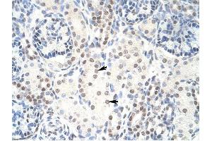 HKR1 antibody was used for immunohistochemistry at a concentration of 4-8 ug/ml to stain Epithelial cells of renal tubule (arrows) in Human Kidney. (HKR1 antibody  (C-Term))