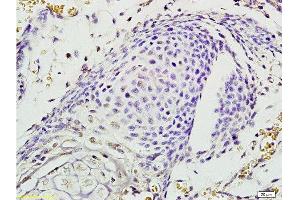 Formalin-fixed and paraffin embedded mouse embryo labeled with Rabbit Anti EphA7/Eph receptor A7 Polyclonal Antibody, Unconjugated  at 1:200 followed by conjugation to the secondary antibody and DAB staining (EPH Receptor A7 antibody  (AA 181-280))