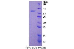 SDS-PAGE (SDS) image for Antigen Identified By Monoclonal Antibody Ki-67 (MKI67) (AA 2386-2674) protein (His tag) (ABIN2125568) (Ki-67 Protein (AA 2386-2674) (His tag))