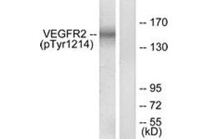 Western blot analysis of extracts from HepG2 cells treated with Na3VO4 0. (VEGFR2/CD309 antibody  (pTyr1214))