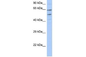 WB Suggested Anti-TMCC3 Antibody Titration:  0. (TMCC3 antibody  (N-Term))