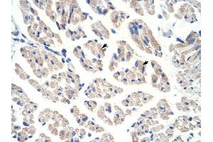 ACO1 antibody was used for immunohistochemistry at a concentration of 12. (Aconitase 1 antibody  (N-Term))