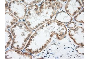 Immunohistochemical staining of paraffin-embedded Human Kidney tissue using anti-LOX mouse monoclonal antibody. (LOX antibody  (AA 22-168))