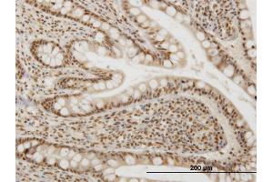 Immunoperoxidase of monoclonal antibody to OXSR1 on formalin-fixed paraffin-embedded human small Intestine. (OXSR1 antibody  (AA 351-450))