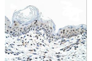 Immunohistochemistry (IHC) image for anti-COP9 Constitutive Photomorphogenic Homolog Subunit 2 (Arabidopsis) (COPS2) (N-Term) antibody (ABIN2780578) (COPS2 antibody  (N-Term))