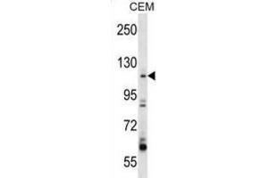 Western Blotting (WB) image for anti-rho Guanine Nucleotide Exchange Factor (GEF) 1 (ARHGEF1) antibody (ABIN2998307) (ARHGEF1 antibody)