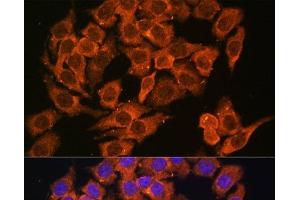 Immunofluorescence analysis of HeLa cells using MYO6 Polyclonal Antibody at dilution of 1:100. (Myosin VI antibody)