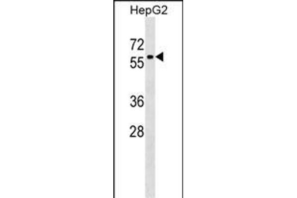 ZNF419 antibody  (AA 176-202)