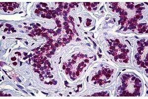Human Breast: Formalin-Fixed, Paraffin-Embedded (FFPE) (STAG2 antibody  (AA 1130-1232))