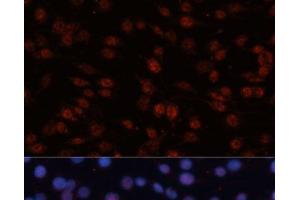 Immunofluorescence analysis of C6 cells using TCF4 Polyclonal Antibody at dilution of 1:100 (40x lens). (TCF4 antibody)