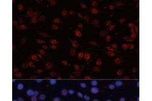 Immunofluorescence analysis of C6 cells using TCF4 Polyclonal Antibody at dilution of 1:100 (40x lens). (TCF4 antibody)