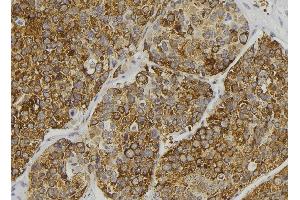 ABIN6279111 at 1/100 staining Human pancreas tissue by IHC-P. (ALMS1 antibody  (C-Term))