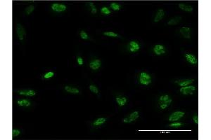 Immunofluorescence of monoclonal antibody to STK32B on HeLa cell. (STK32B antibody  (AA 314-414))