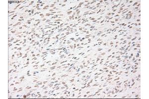 Immunohistochemical staining of paraffin-embedded colon tissue using anti-USP13mouse monoclonal antibody. (USP13 antibody)