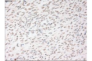 Immunohistochemical staining of paraffin-embedded colon tissue using anti-USP13mouse monoclonal antibody.
