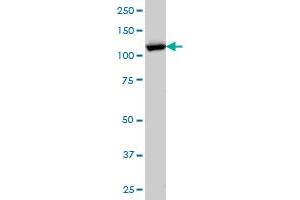 RANBP5 monoclonal antibody (M01), clone 1C4 Western Blot analysis of RANBP5 expression in HeLa . (Importin 5 antibody  (AA 1-100))