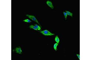 Immunofluorescent analysis of Hela cells using ABIN7172969 at dilution of 1:100 and Alexa Fluor 488-congugated AffiniPure Goat Anti-Rabbit IgG(H+L) (Tmc2 antibody  (AA 6-206))