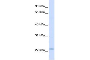 REEP1 antibody used at 1 ug/ml to detect target protein. (Receptor Accessory Protein 1 antibody  (C-Term))