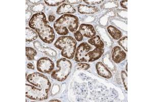 Immunohistochemical staining of human kidney with OGT polyclonal antibody  shows moderate cytoplasmic positivity in cells in tubules at 1:10-1:20 dilution.