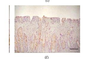 Expression of DAO and ODC in different colonic pathological conditions. (ODC1 antibody  (AA 321-461))