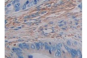 Immunohistochemistry (IHC) image for anti-Filamin C, gamma (FLNC) (AA 17-259) antibody (ABIN7441958)