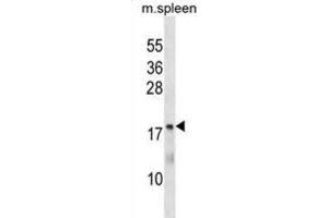 Western Blotting (WB) image for anti-5,10-Methenyltetrahydrofolate Synthetase (5-Formyltetrahydrofolate Cyclo-Ligase) (MTHFS) antibody (ABIN3000360)