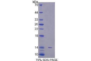 SDS-PAGE (SDS) image for Signal Transducer and Activator of Transcription 5A (STAT5A) (AA 586-688) protein (His tag) (ABIN1171373) (STAT5A Protein (AA 586-688) (His tag))