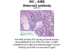 Image no. 1 for anti-Autoimmune Regulator (AIRE) (Internal Region) antibody (ABIN1731636) (AIRE antibody  (Internal Region))