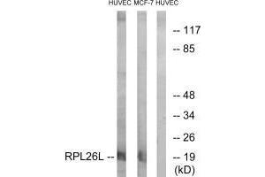Western blot analysis of extracts from HUVEC cells and MCF-7 cells, using RPL26L antibody. (RPL26L1 antibody  (C-Term))