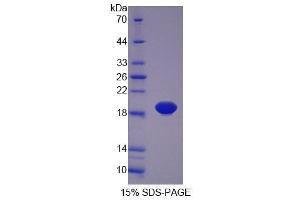 SDS-PAGE analysis of Rat PLTP Protein. (PLTP Protein)