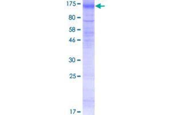 SLC26A4 Protein (AA 1-780) (GST tag)