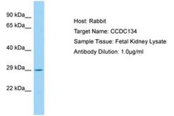 CCDC134 Antikörper  (AA 143-192)