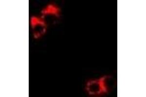 Immunofluorescent analysis of DDX1 staining in Hela cells. (DDX1 antibody)