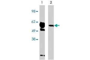 Western blot using FBXW7 polyclonal antibody on human brain lysate (15 ug/lane).